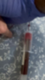 A phlebotomist drawing blood from a patient’s arm using a single collection tube.