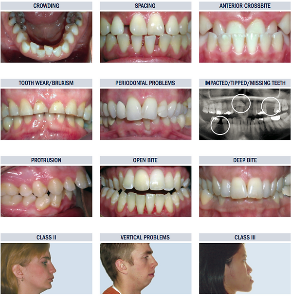 columbia tn orthodontist, spring hill tn orthodontist, lawrenceburg tn orthodontist