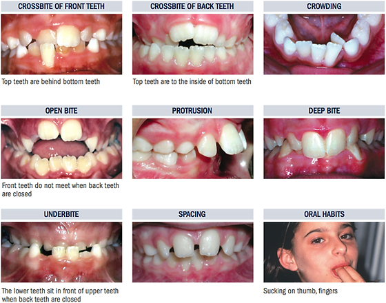 Wilson Orthodontics Columbia Tn Orthodontist Orthodontic Problems