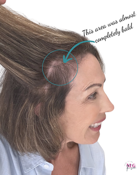 Why I Was Losing Hair in Menopause — And the Plant-Based Changes That Brought It Back