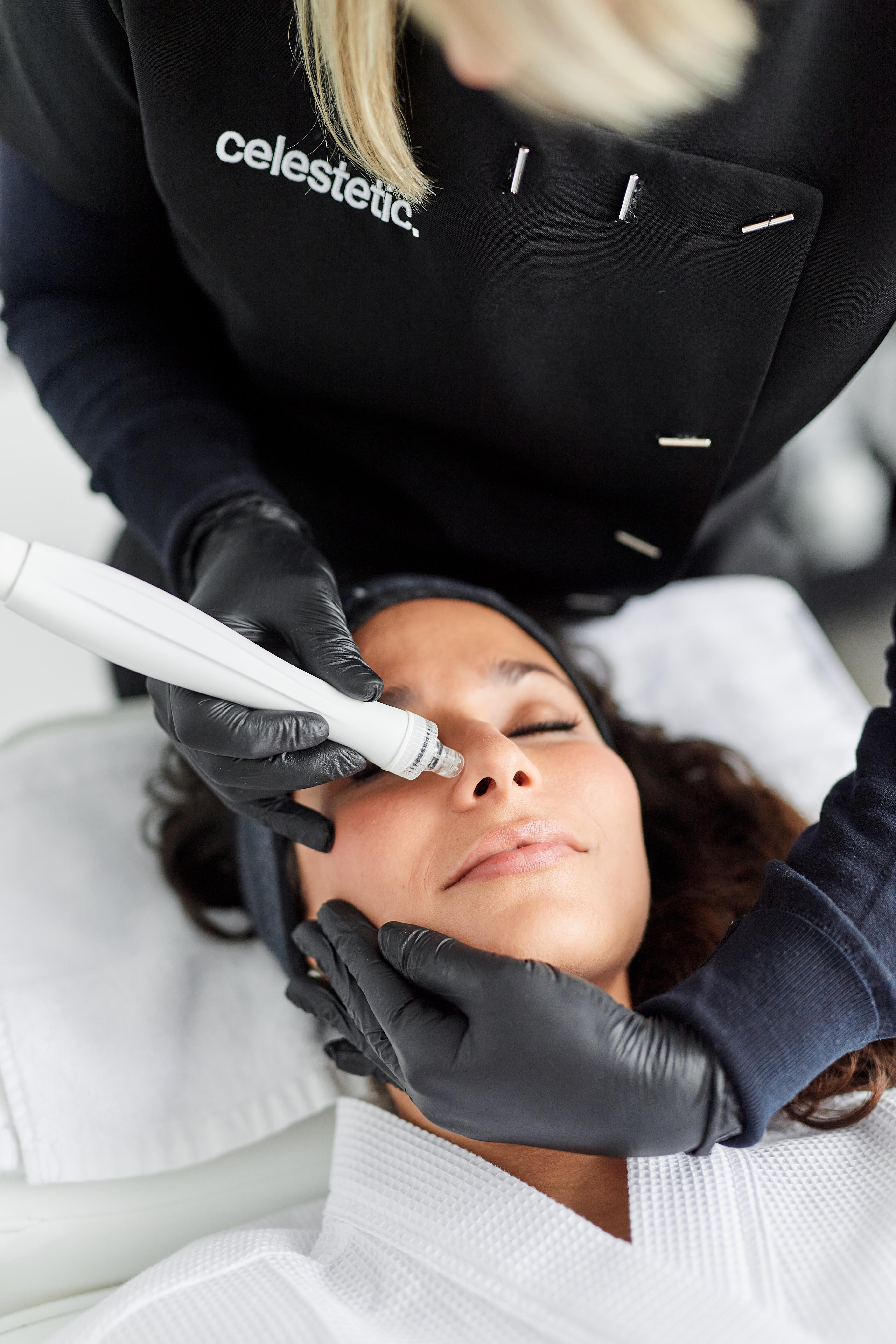 Close-up hydrafacial hydrodermabrasie behandeling op neus voor poriënreiniging