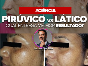 Lático 90% vs. Pirúvico 40% no tratamento do melasma: qual entrega melhores resultados?
