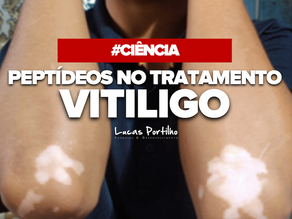 Peptídeos no tratamento do Vitiligo