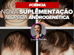 Suplementação Oral na Alopecia: Evidências de Novo Estudo Clínico