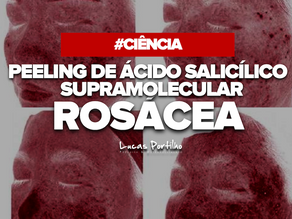 Tratamento da rosácea papulopustular com salicílico supramolecular 30%