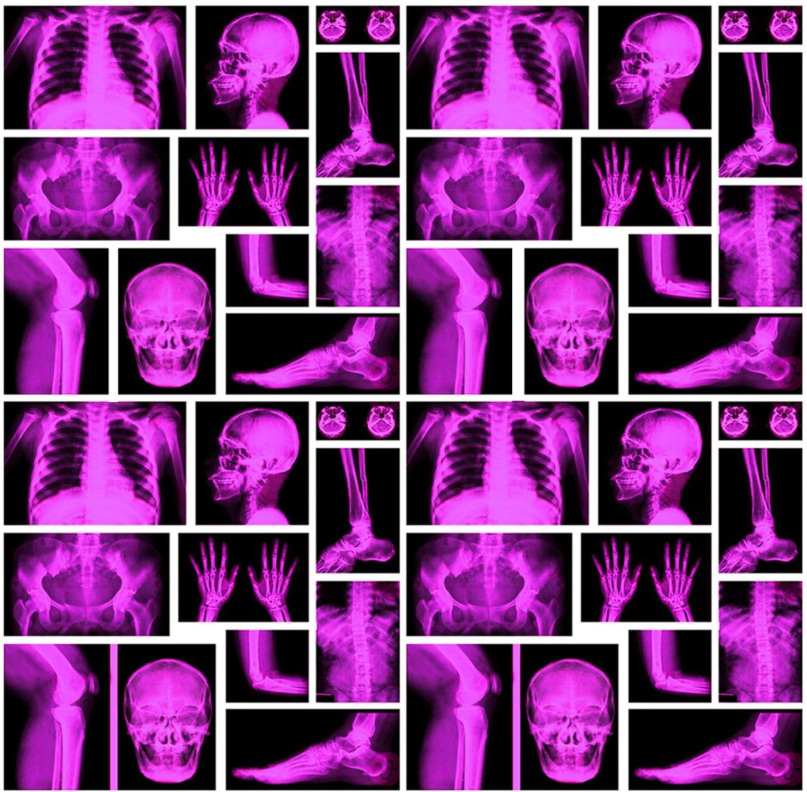 Microfibra Radiografía Rosa