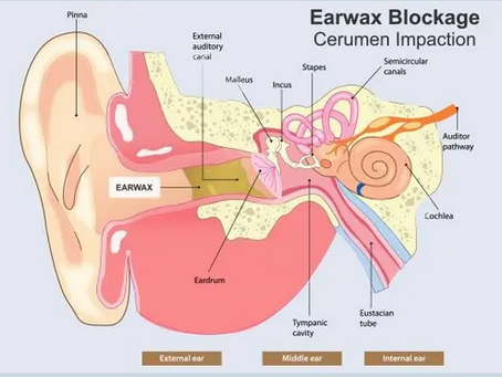 Don't Miss a Beat: Why Your Family Doctor Should Always Check Your Ears