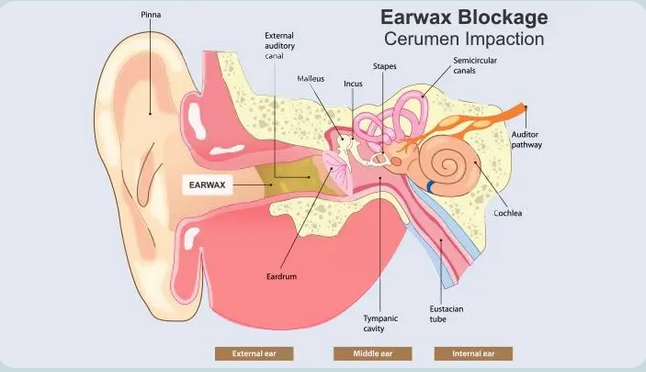 Don't Miss a Beat: Why Your Family Doctor Should Always Check Your Ears