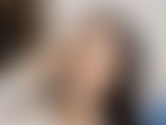 Rhinoplasty for a Crooked Nose Causes and Treatment Options