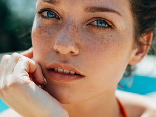 How to Maintain Results After Melasma Treatment?