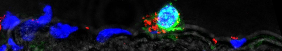 MAX_ApoE7775 plaque S82 CD8 PD1 CD44 93x 3D2 Pub.tif (RGB)-2.tif