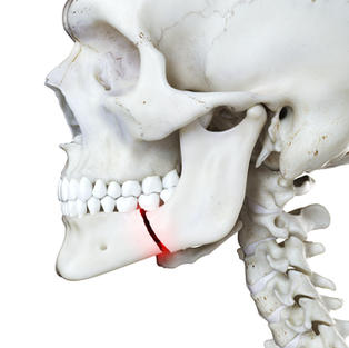 Dental Emergency