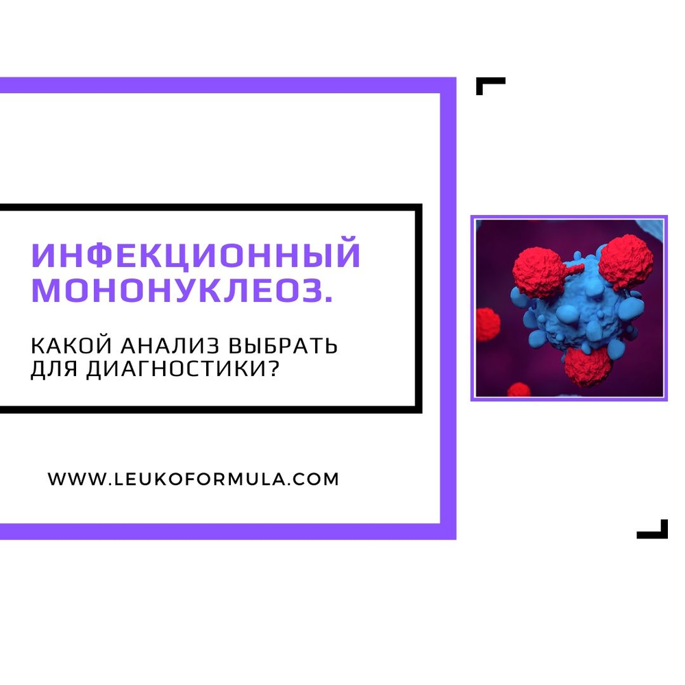 Инфекционный мононуклеоз. Какой анализ выбрать для диагностики ВЭБ: IgM ...
