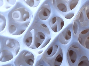 Natural Remedies for Osteoporosis in India