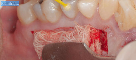 Resina flow.005.jpeg