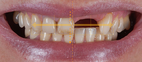 Segundo caso clinico.004.jpeg