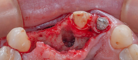 Segundo caso clinico.017.jpeg