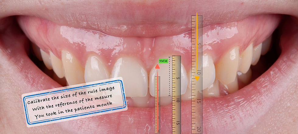 Crown lengthening .011.jpeg