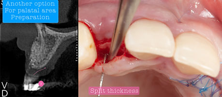 Compromized Implants .108.jpeg