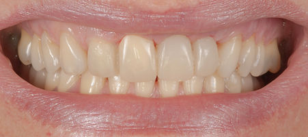 Segundo caso clinico.023.jpeg