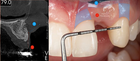 Compromized Implants .086.jpeg