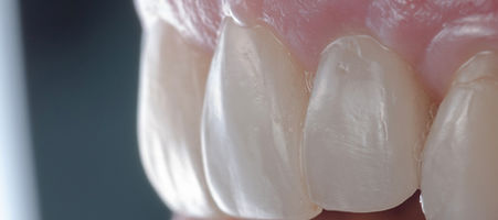 Segundo caso clinico.054.jpeg