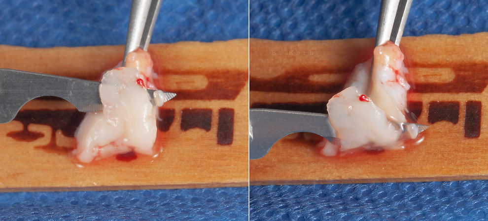 Compromized Implants .106.jpeg