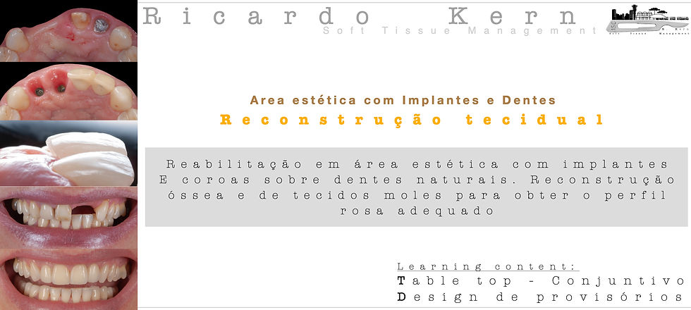 Table Top CT Graft.001.jpeg