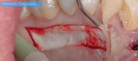 Resina flow.009.jpeg