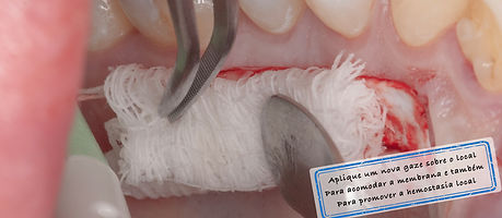 Resina flow.023.jpeg