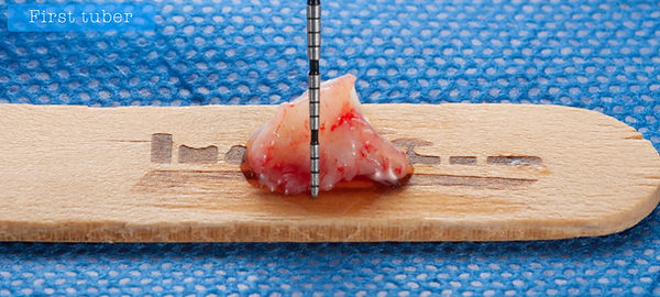 Compromized Implants .083.jpeg
