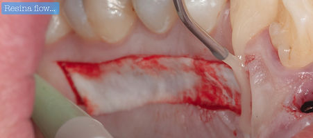 Resina flow.025.jpeg