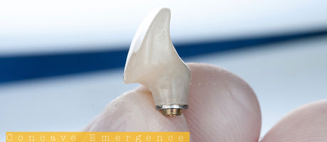 Segundo caso clinico.046.jpeg