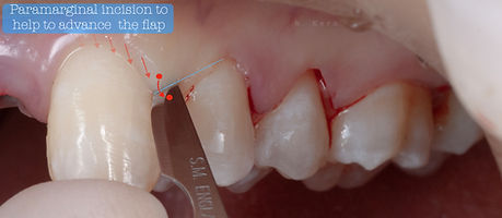 Compromized Implants .011.jpeg