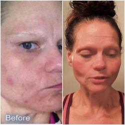 CARISA BEFORE AND AFTER