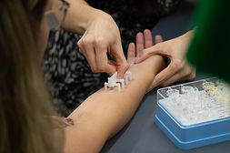 Prick Test Cursos IBAI