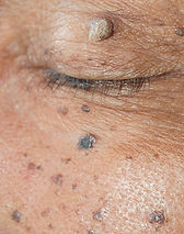 Bio-Hack, Longevity, Lifespan, Long Life, Health-Span, Health-Span Extension, Aging, Anti-Aging, Reverse Aging, Aging Reversal, Healthy Aging, , Natural, Old, Senior, Retired, Retirement, Aged, Anti-Wrinkle, Lifespan Extension, Endocrine System, Hormonal System, Immune System, Immune Defense, Digestive System, Digestion, Intestinal System, Stomach, Urinary System, Kidney, Kidney Stones, Prostate Health, Reproductive System, Fertility, Fertile, Muscular System, Skeletal System, Bones, Osteoporosis, Skin, Hair, Nails, Sensory System, Cordyceps , Lions Mane, Turkey Tail, Chaga, Shiitake, Maitake, Reishi, Mushrooms, Nicotinamide, NAD, Resveratrol, Zinc, Acai, Lycopene, Chlorella, Psyllium, Maca, Saw Palmetto, Bacopa, Ginseng, Astragalus, Cayenne Pepper, Tribulus, Licorice, L-Arginine, Creatine, Nitric Oxide, Papain, Green Tea, Bilberry, Huperzine, Grape Seeds, Garlic, Fish Oil, Biotin, Folic Acid, Calcium, Iron, Magnesium, Selenium, Chromium, Copper, Iron, Manganese, Chamomile, GABA
