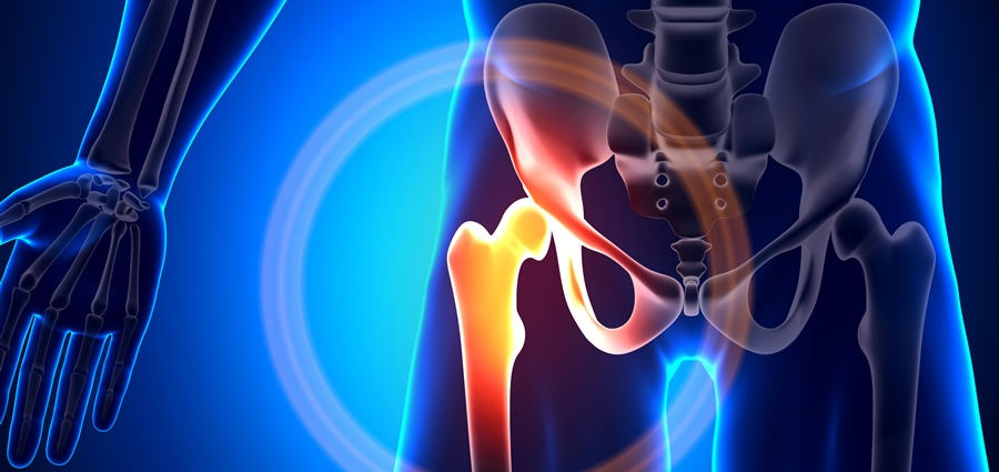 Hip Bursitis - Balance in Motion, Santa Barbara Bodywork and Massage Therapy