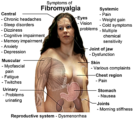 Balance in Motion, Santa Barbara Pain Therapy - Fibromyalgia Symptoms