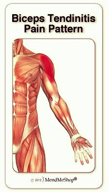 Tendonitis Hands - Balance in Motion Bodywork, Santa Barbara Massage Therapy