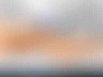  Is Laser Hair Removal Worth It?