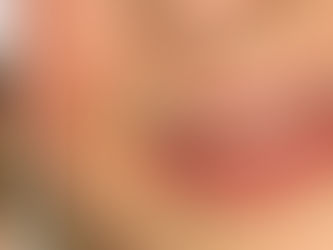 How to remove facial hair?