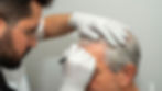 Aura beauty clinic scandinavia - hårtransplantation