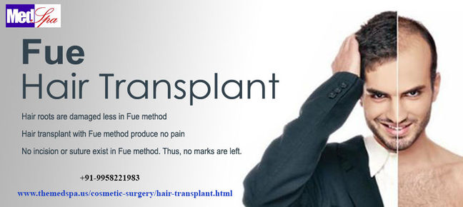 Three Factors Which Affect Hair Transplant Surgery Cost in Delhi