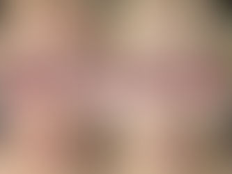 赤み鎮静はララピールにおまかせ!