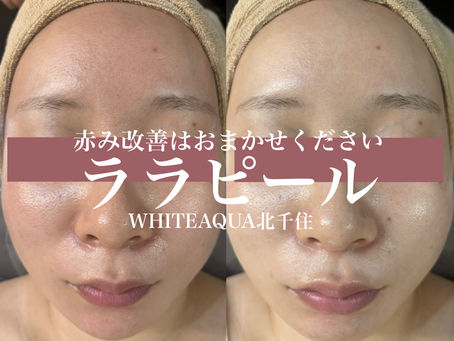 赤み鎮静はララピールにおまかせ!