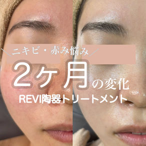 陶器トリートメント2ヶ月の変化