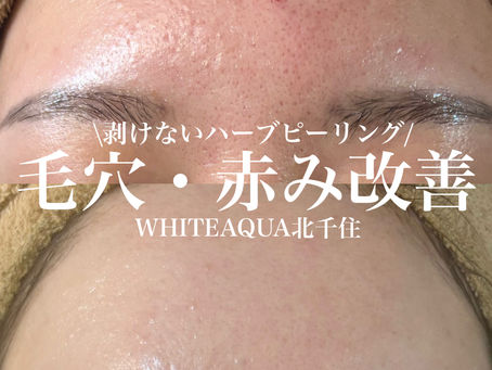 ハーブピーリングで毛穴、赤み改善