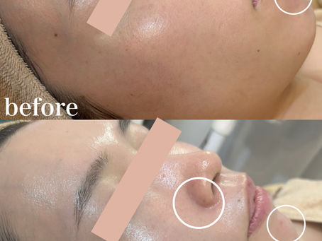 乾燥に負けないお肌へ