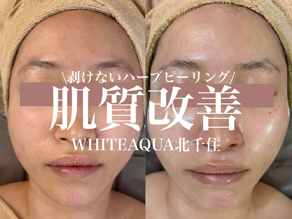 肌質改善するならWHITEAQUA北千住店🫧🌿